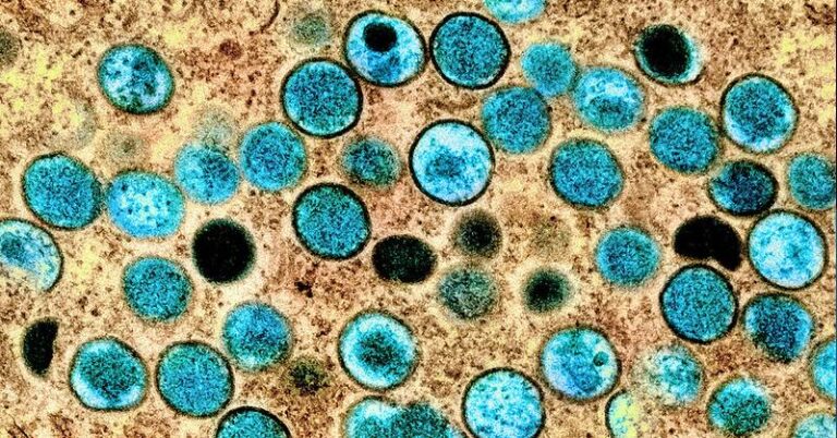 Colorized transmission electron micrograph of monkeypox virus particles (teal) cultivated and purified from cell culture, Image