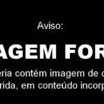 imagem forte - criança desnutrida